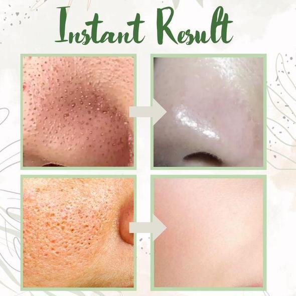 DermaEase™ Green Tea Deep Cleanse Mask Stick