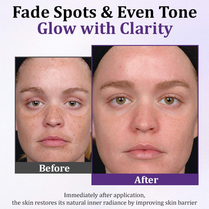 ATTDX® PigmentaX ProFade Anti-Hyperpigmentation Cream
