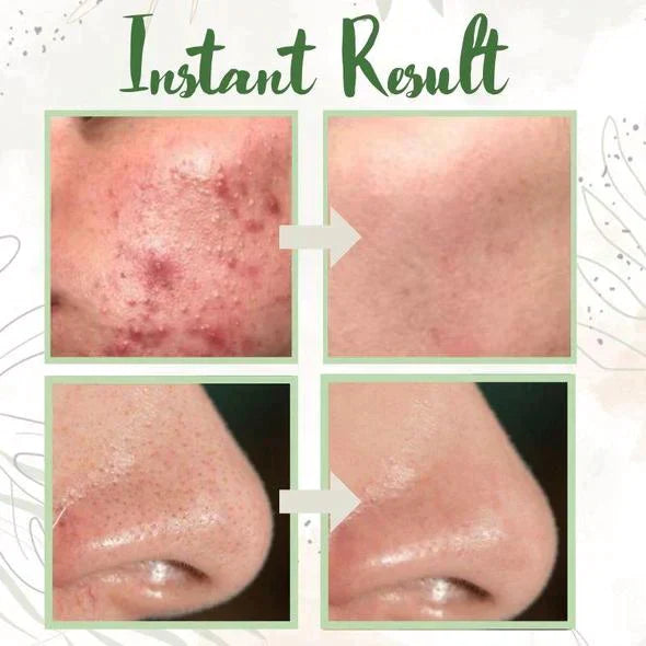 DermaEase™ Green Tea Deep Cleanse Mask Stick