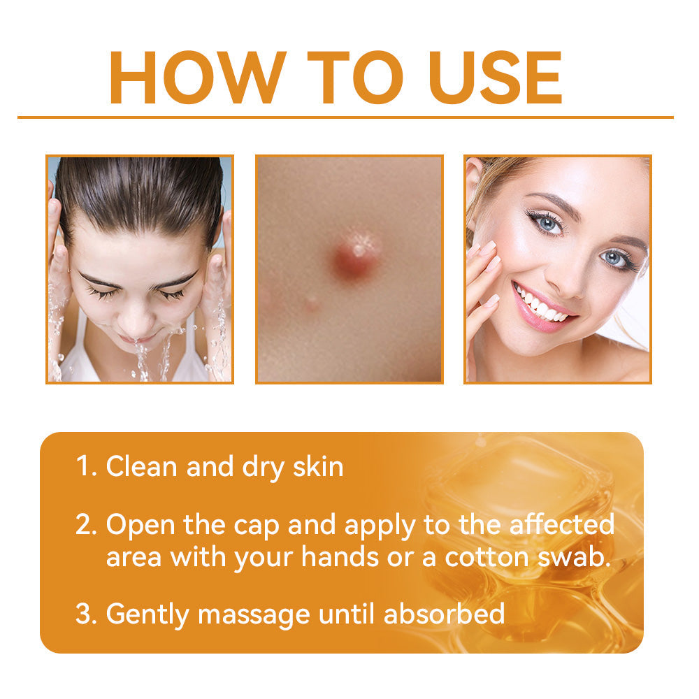 ApisDerm™ Advanced Bee Venom Skin Treatment Cream
