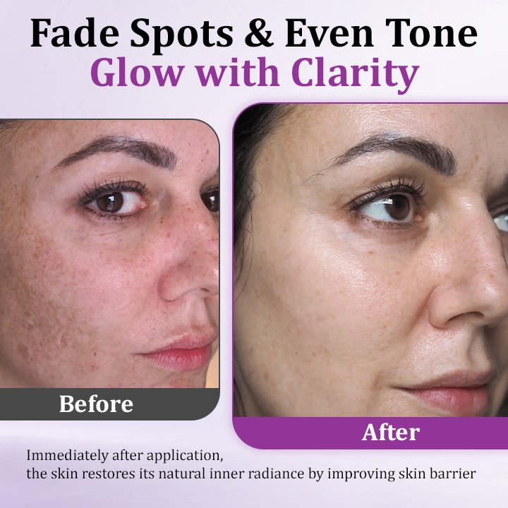 ATTDX® MelantraX Advanced Anti-Hyperpigmentation Essence