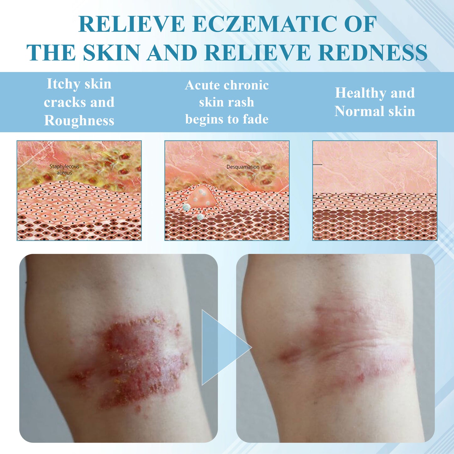 ATTDX® C+ Multi-Skin Rescue Therapy Cream
