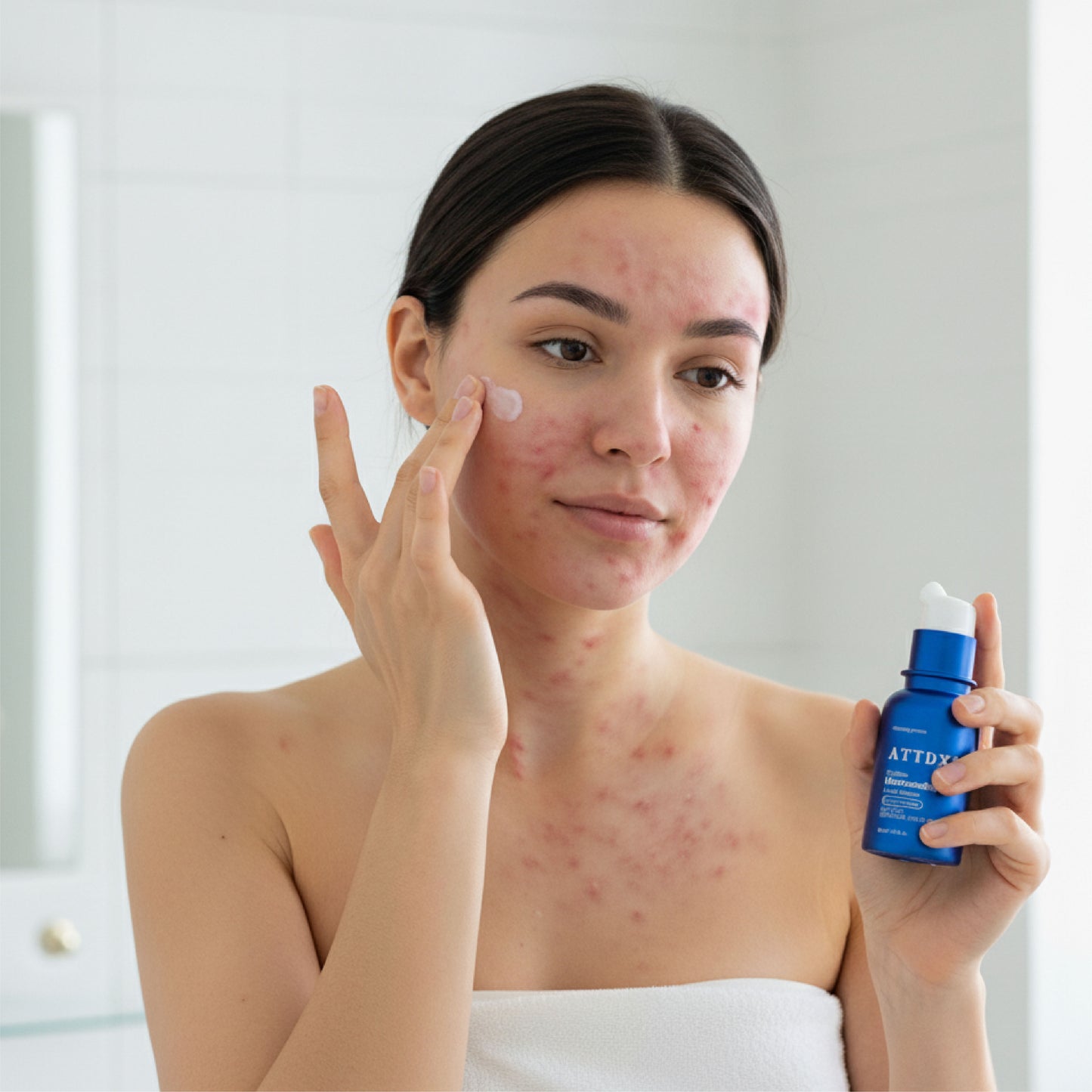 🔥TikTok Hot Sellers- ATTDX® ExoRefine Microneedling Liquid Essence
