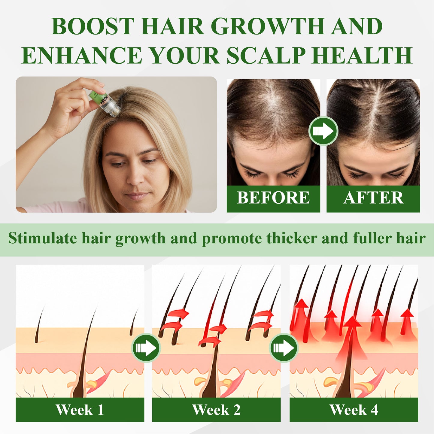 🔥TikTok Hot Sellers- ATTDX® LadyGro EGCG Microneedle Scalp Essence Kit
