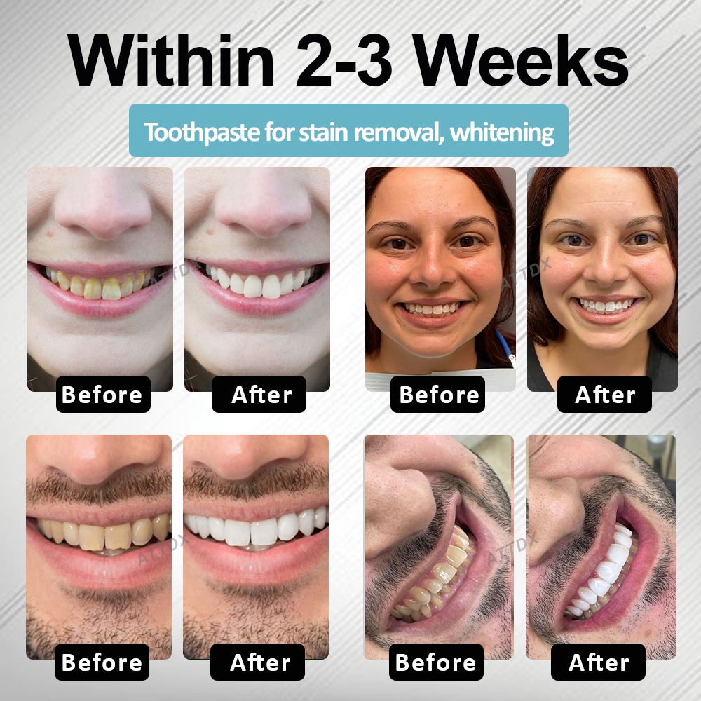🔥TikTok Hot Sellers- ATTDX® MaxNHA Whitening Repair Toothpaste