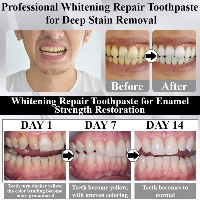 🔥TikTok Hot Sellers- ATTDX® MaxNHA Whitening Repair Toothpaste