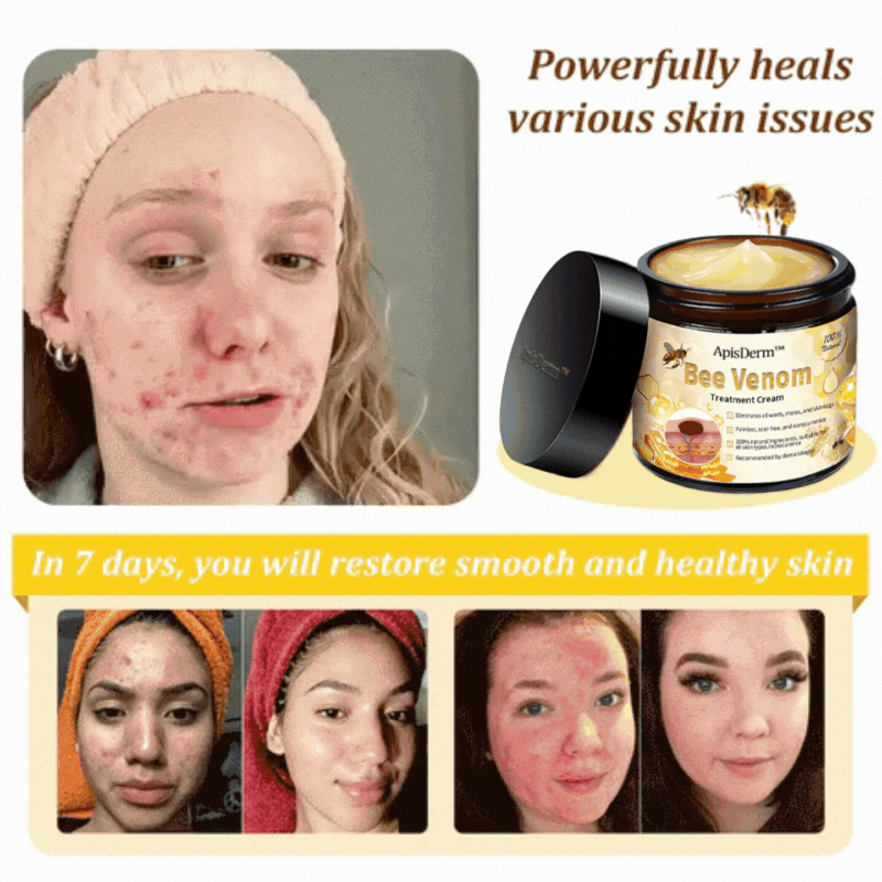 ApisDerm™ Advanced Bee Venom Skin Treatment Cream