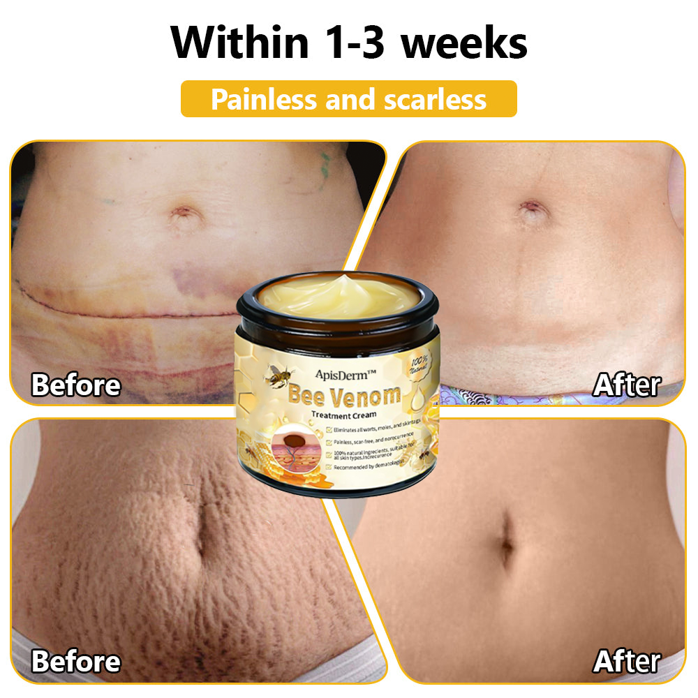 ApisDerm™ Advanced Bee Venom Skin Treatment Cream