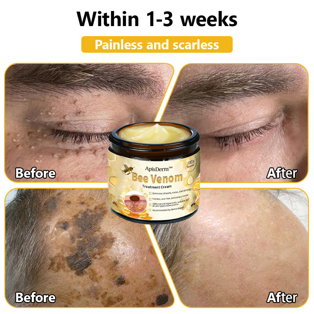 ApisDerm™ Advanced Bee Venom Skin Treatment Cream
