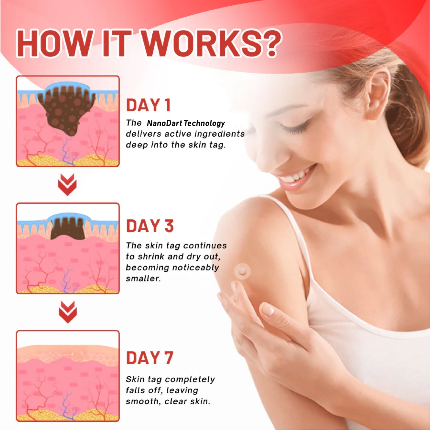 DermaEase™ NanoDart Skin Tag Removal Patches