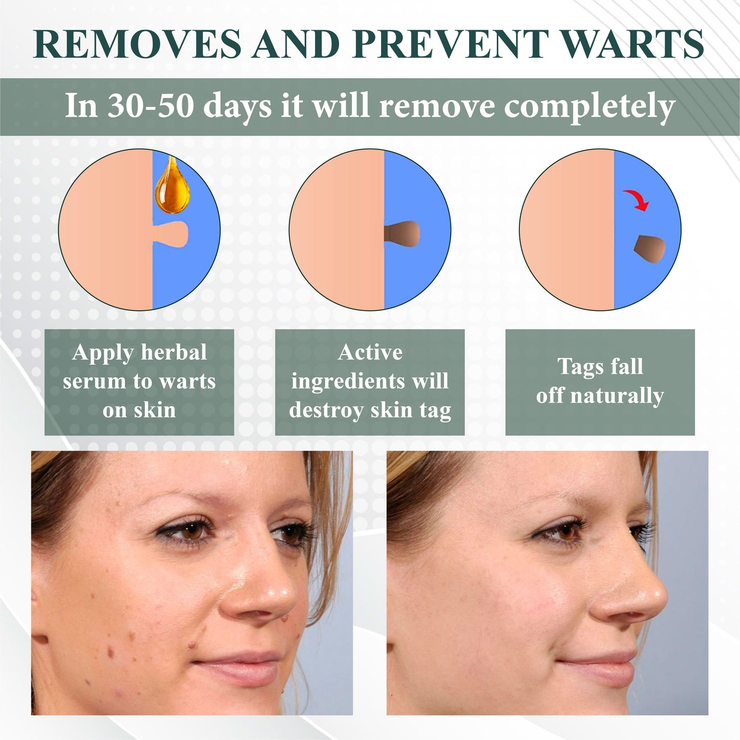 ATTDX® Mole Away Multi-Clear Apis Herbal Cream
