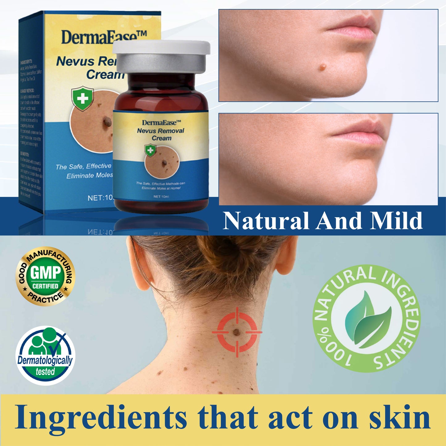 DermaEase™ Nevus Removal Cream