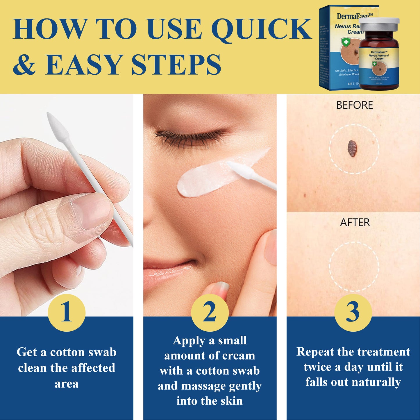 DermaEase™ Nevus Removal Cream