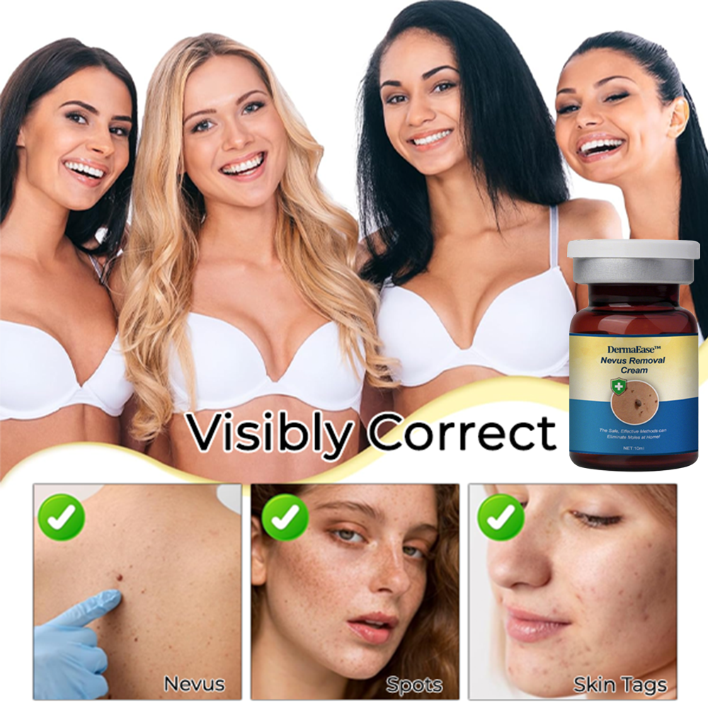 DermaEase™ Nevus Removal Cream