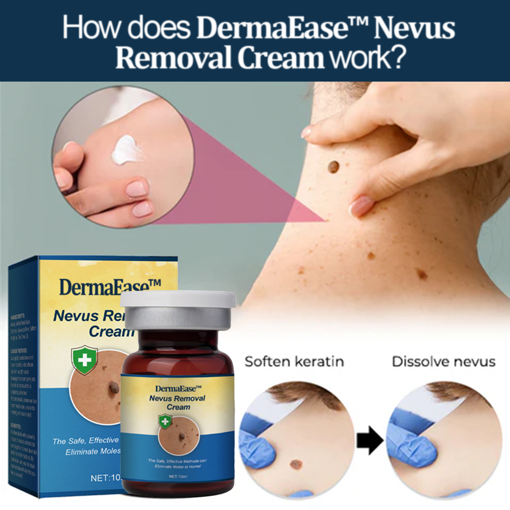 DermaEase™ Nevus Removal Cream