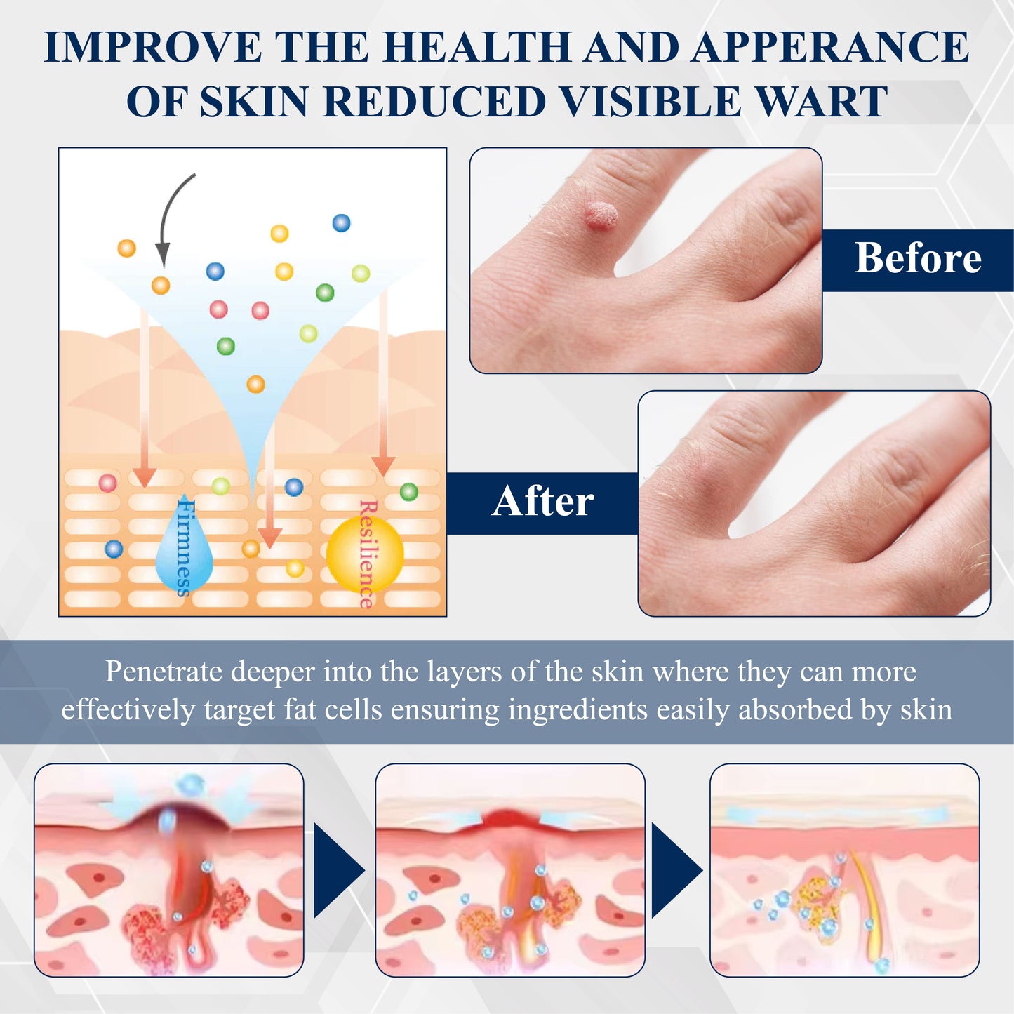 DermaEase™ Tag Wart Removal Herbal Serum