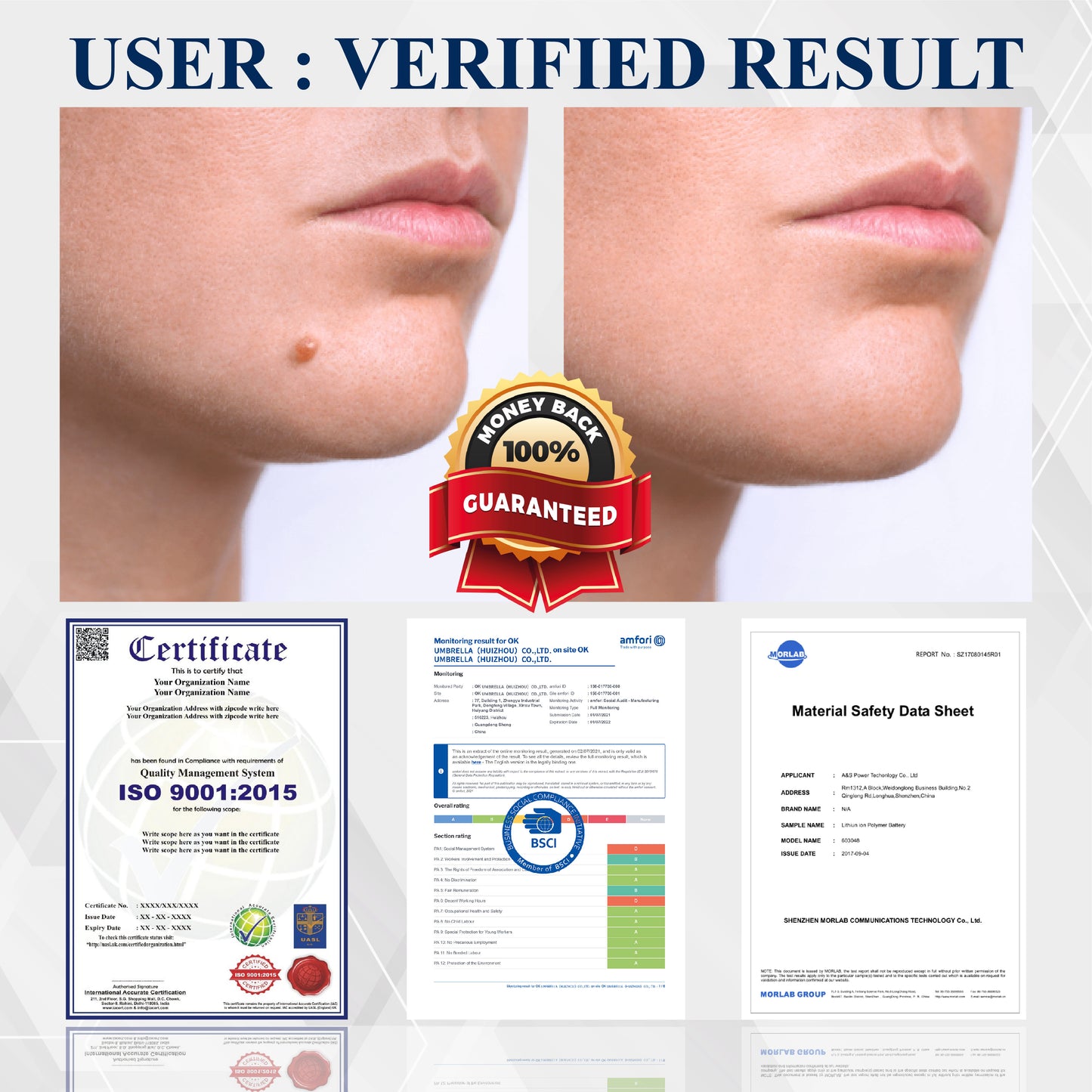 DermaEase™ Tag Wart Removal Herbal Serum
