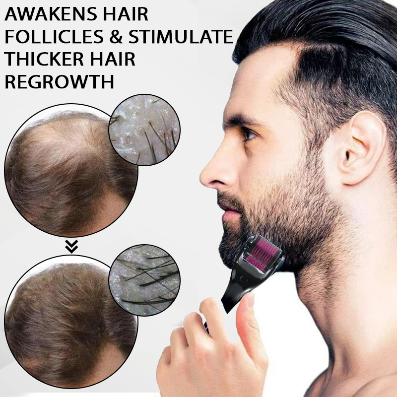 🔥TikTok Hot Sellers- ATTDX® Max Absorb MinoxidilSerum Dermaroller Kit