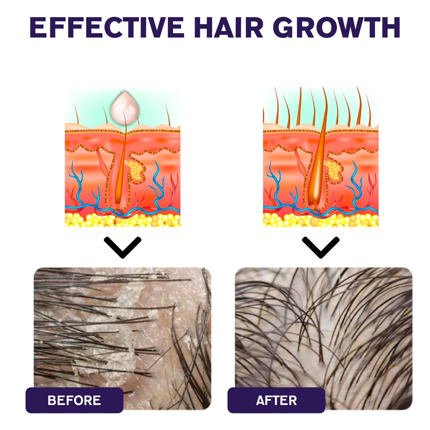 ATTDX™ Hair Regrowth Ginger Shampoo Bar