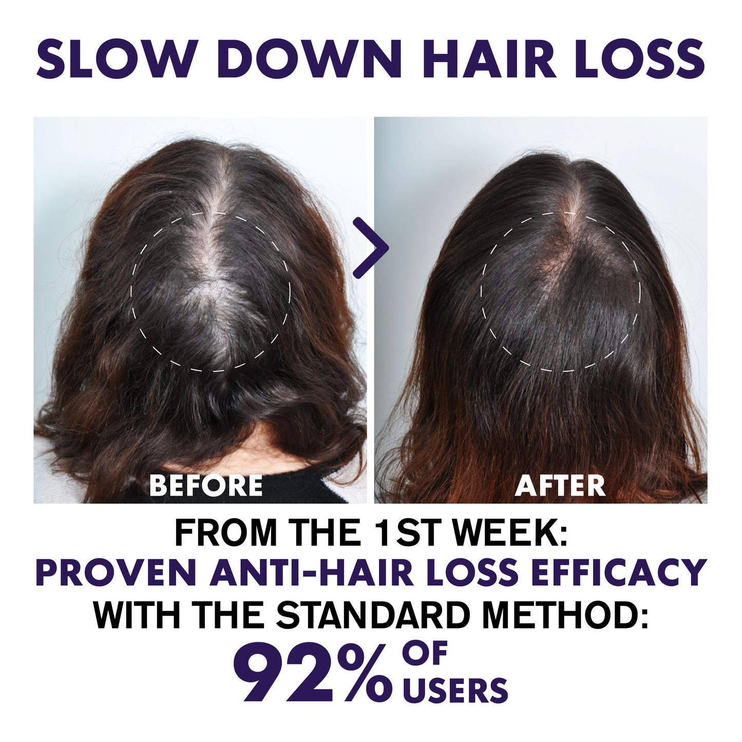 ATTDX™ Hair Regrowth Ginger Shampoo Bar