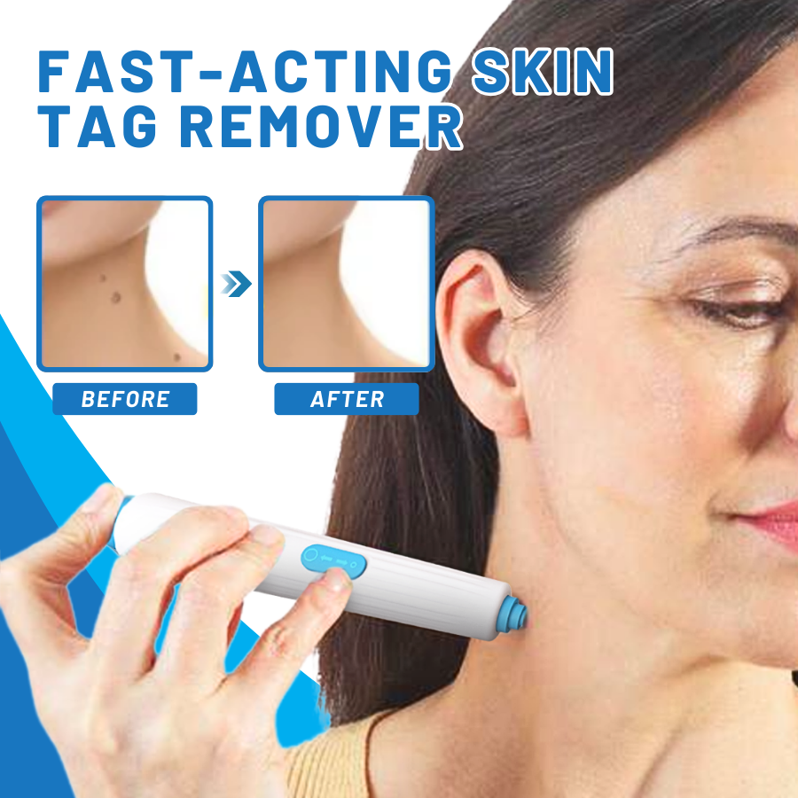 DermaEase™ Gentle Heal Skin Tag Pen Kit