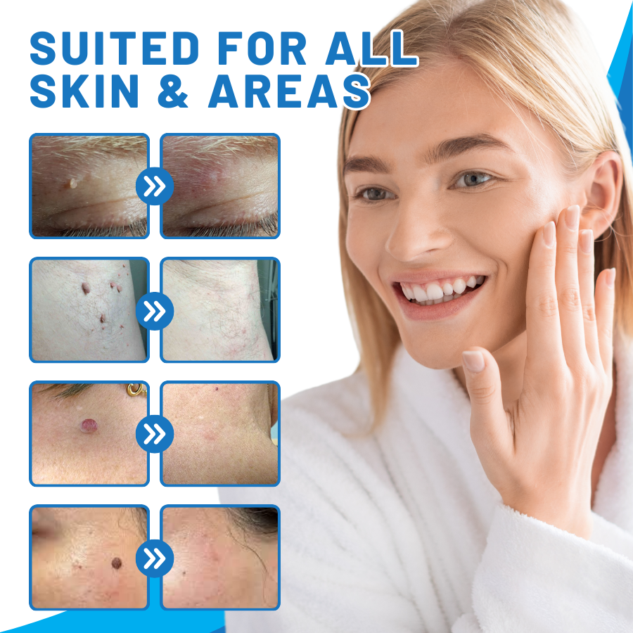 DermaEase™ Gentle Heal Skin Tag Pen Kit