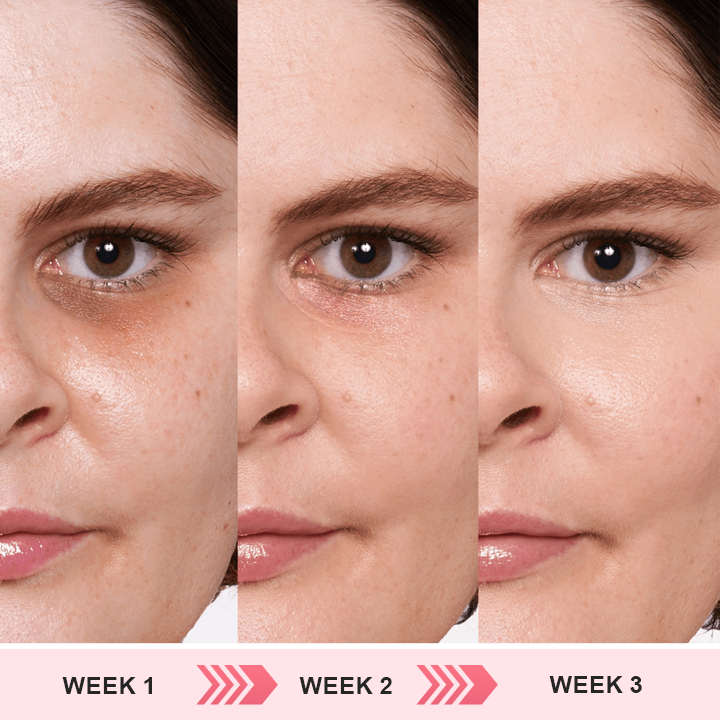 DermaEase⢠Retinol Eye Stick