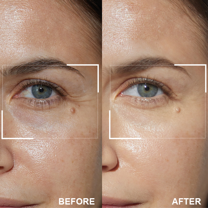 DermaEase⢠Retinol Eye Stick