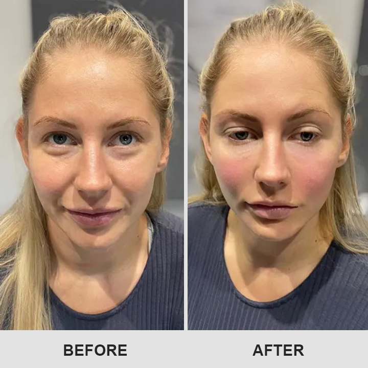 DermaEase⢠Retinol Eye Stick