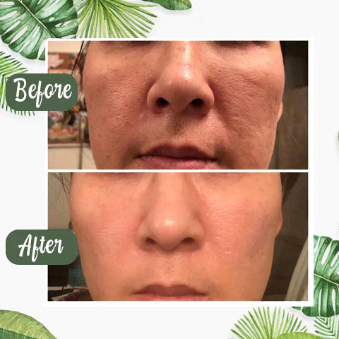 DermaEase™ Green Tea Deep Cleanse Mask Stick