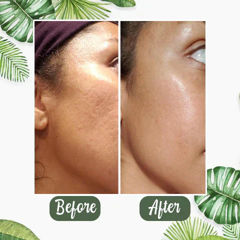 DermaEase™ Green Tea Deep Cleanse Mask Stick