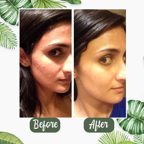 DermaEase™ Green Tea Deep Cleanse Mask Stick