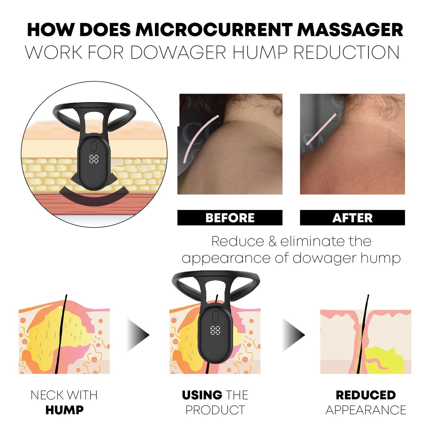 CircuWave™ UltraSpa Lymphvity PostureCorrector Neck Instrument