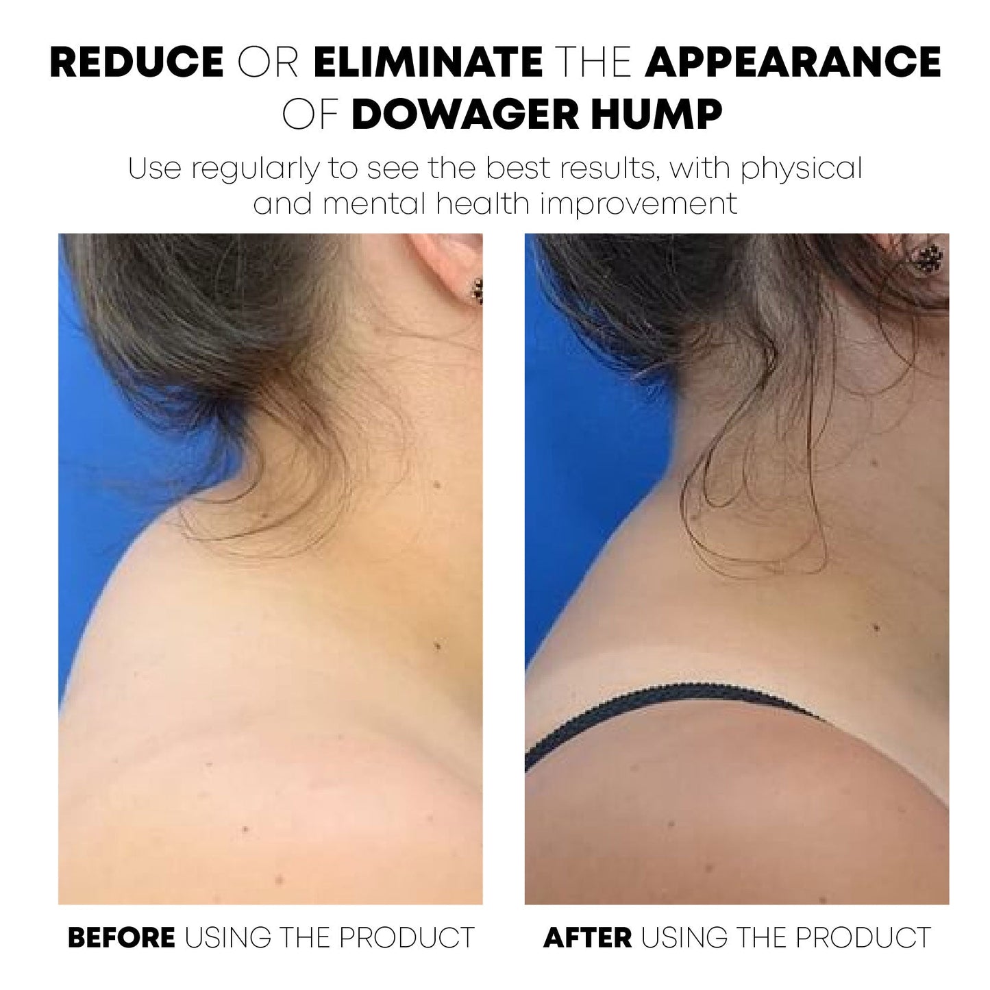 CircuWave™ UltraSpa Lymphvity PostureCorrector Neck Instrument