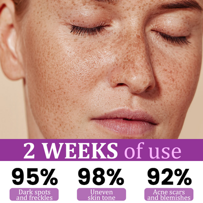 ATTDX® MelantraX Advanced Anti-Hyperpigmentation Essence
