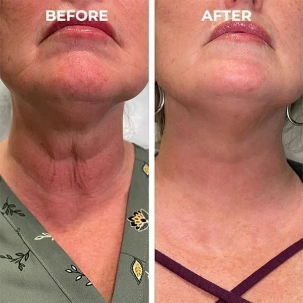 ATTDX® SkinFirming Rejuvenating Serum