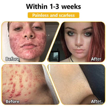 ApisDerm™ Advanced Bee Venom Skin Treatment Cream