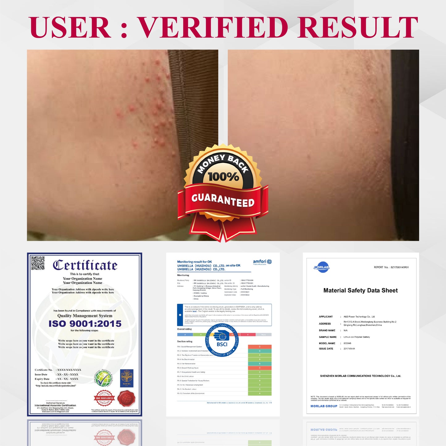 🔥TikTok Hot Sellers- ATTDX® EndoLynx VulvaCare HPV Defense Cream