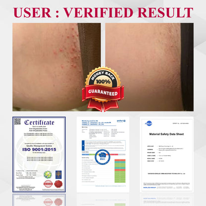 🔥TikTok Hot Sellers- ATTDX® EndoLynx VulvaCare HPV Defense Cream