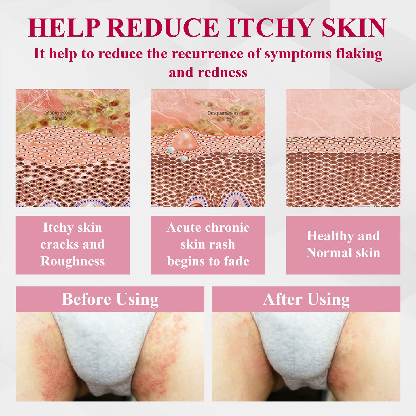 🔥TikTok Hot Sellers- ATTDX® EndoLynx VulvaCare HPV Defense Cream