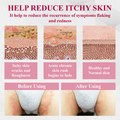 🔥TikTok Hot Sellers- ATTDX® EndoLynx VulvaCare HPV Defense Cream