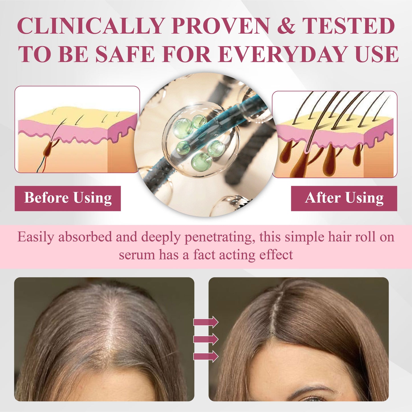 🔥TikTok Hot Sellers- ATTDX® Hair Reawaken PP405 Roll-On Serum for Women 👩