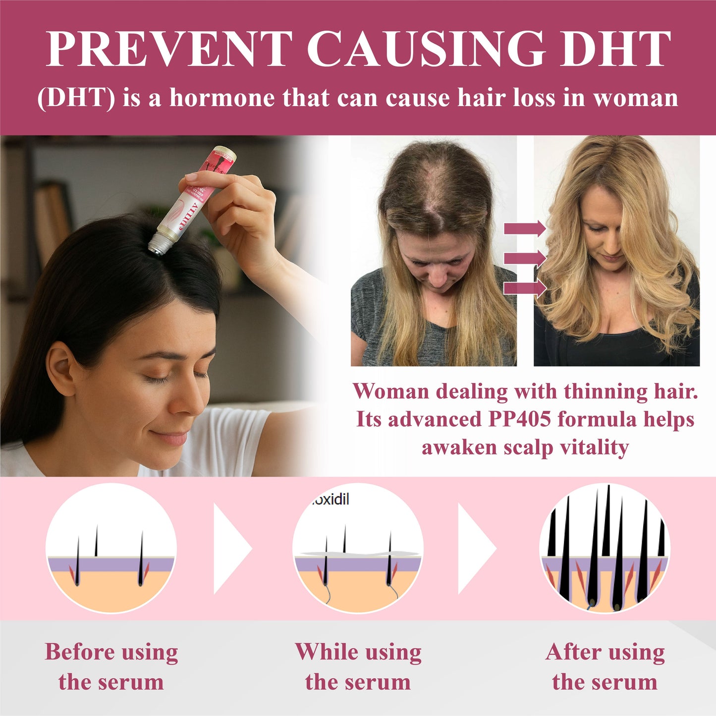 🔥TikTok Hot Sellers- ATTDX® Hair Reawaken PP405 Roll-On Serum for Women 👩