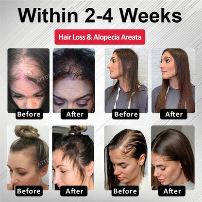 🔥TikTok Hot Sellers- ATTDX® Hair Reawaken PP405 Roll-On Serum for Women 👩