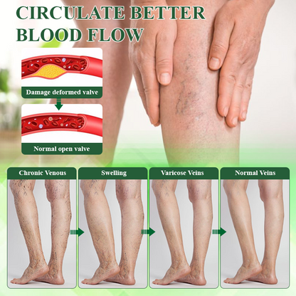 🔥TikTok Hot Sellers- ATTDX® VeinoRoll Therapy Edema Comfort Cream