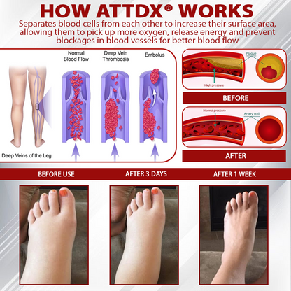 ATTDX® Horse Chestnut LymphoTherm Relief Gel