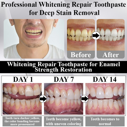 🔥TikTok Hot Sellers- ATTDX® MaxNHA Whitening Repair Toothpaste