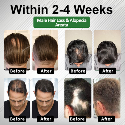🔥TikTok Hot Sellers- ATTDX® ReGain+ Density Renewal Hair Serum
