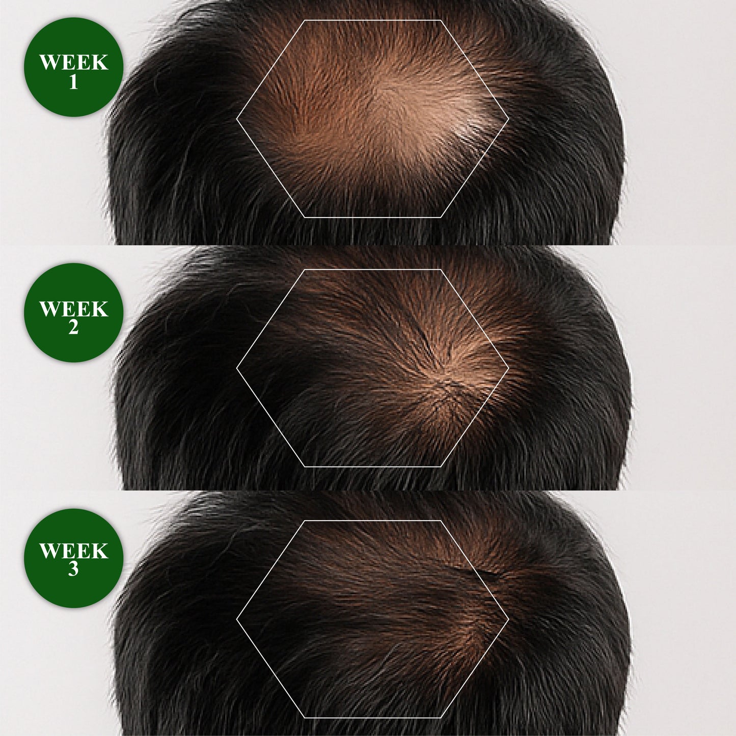 🔥TikTok Hot Sellers- ATTDX® ReGain+ Density Renewal Hair Serum