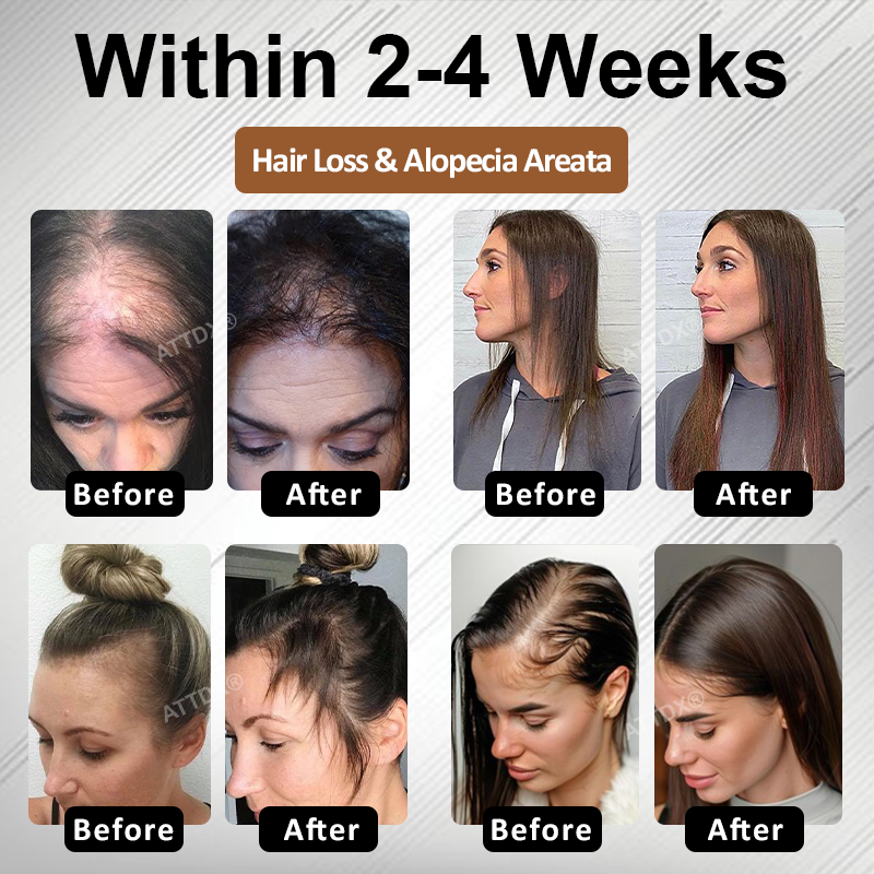 🔥TikTok Hot Sellers- ATTDX® Root Activator Hair Rescue Serum